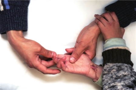 九齡童被養(yǎng)母砍斷手扔茅坑 進(jìn)京求醫(yī)盼激活手腕