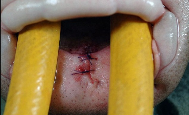 手術(shù)后遺癥？世界上第一條素食鯊魚愛吃芹菜