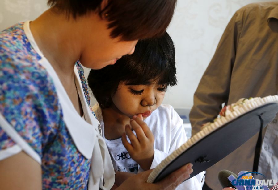 杭州：10歲輟學(xué)“毛孩”受關(guān)愛(ài) 接受面部激光脫毛