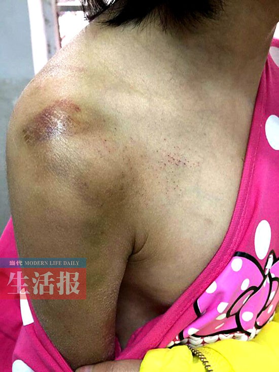 女童常常被“阿姨”毆打 連鄰居都看不過眼了