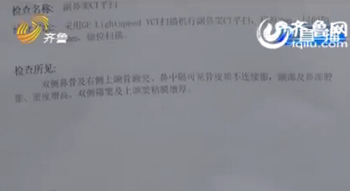 菏澤男孩鼻腔手術后藏20厘米長紗布 7個月后才發現