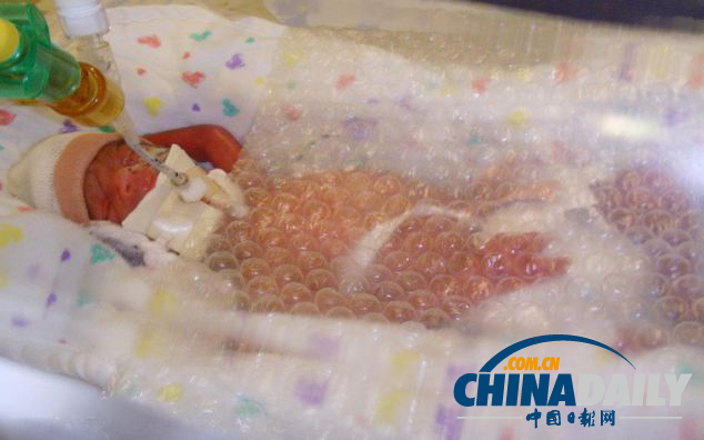 英出生不足1斤女?huà)牍鼩馀莶即婊?/></a></p>

<p align=