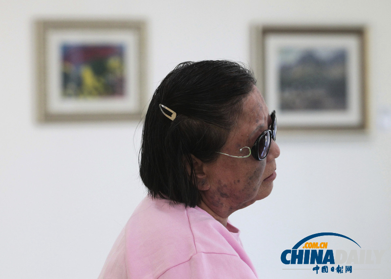 歷史遺留之痛:走近韓國小鹿島麻風病院