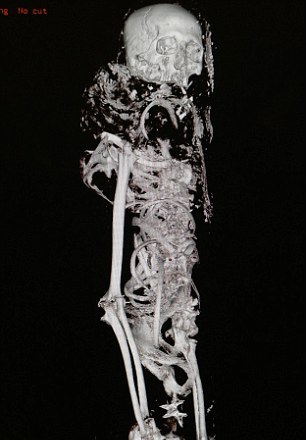 4000歲木乃伊接受CT掃描 “理想患者”毫發(fā)無(wú)損